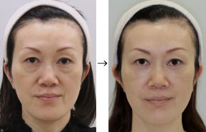 東京都中央区 美容皮膚科 美容外科 皮膚科 形成外科一覧 口コミまとめ